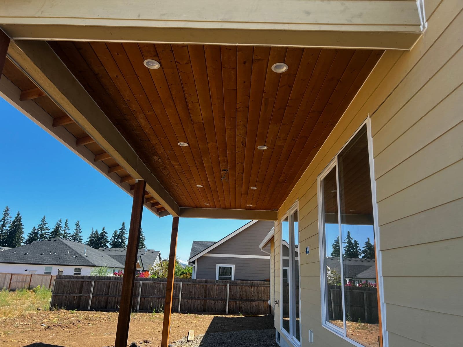 Covered patio with cedar tongue-and-groove ceiling and recessed lighting